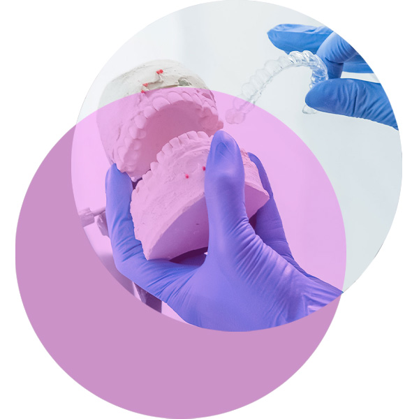 Beispielgebiss mit Invisalign-Zahnschienen zur Korrektur der Zahnstellung